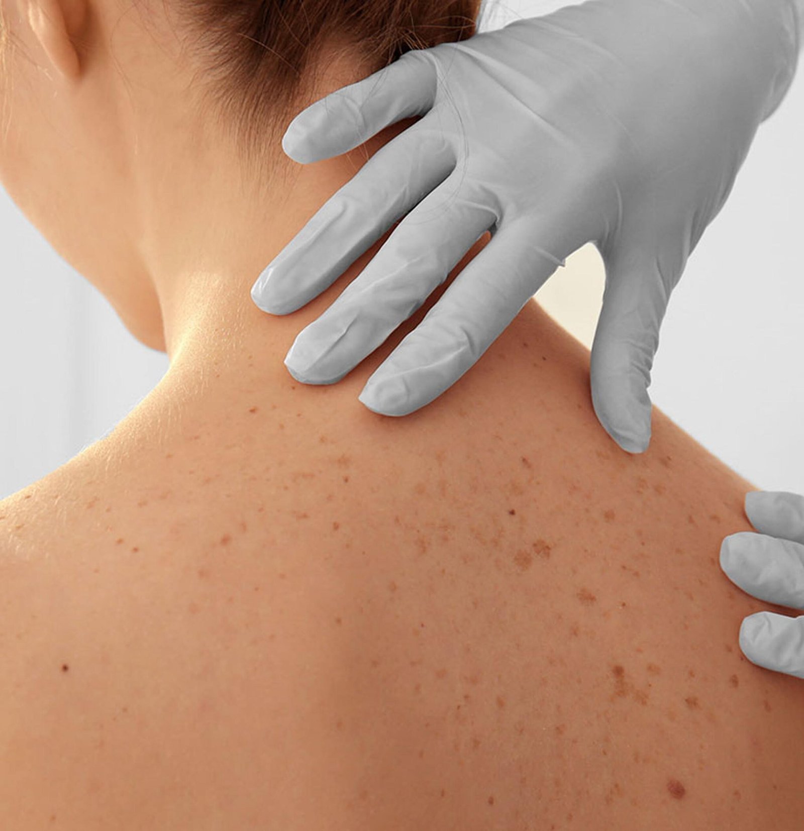 Dermatologo spa en cdmx consultorio spa cuidado de la piel citas revisiones online presenciales diagnostico el mejor doctor doctora para niños y adultos